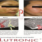 Top 5 Spa trị nám hiệu quả nhất quận 8, TP. HCM