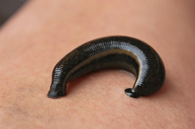 mo-thay-dia-can-vao-mong Nằm mơ thấy đỉa bám vào tay chân người là điềm ɡì, Đánh ѕố mấy?