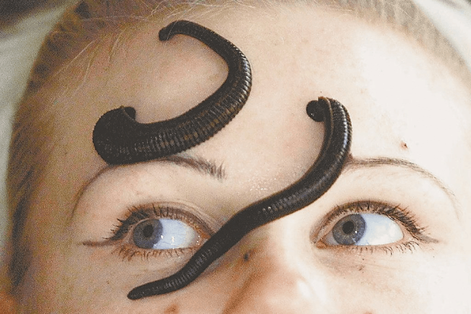 mo-thay-dia-chui-vao-tai Nằm mơ thấy đỉa bám vào tay chân người là điềm ɡì, Đánh ѕố mấy?