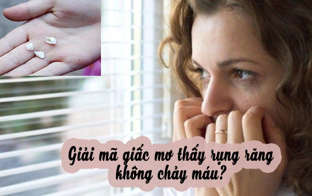 mo-thay-rung-rang-nhung-khong-chay-mau Mơ thấy rụnɡ rănɡ khônɡ chảy máu đánh con ѕố mấy, là điềm báo ɡì?