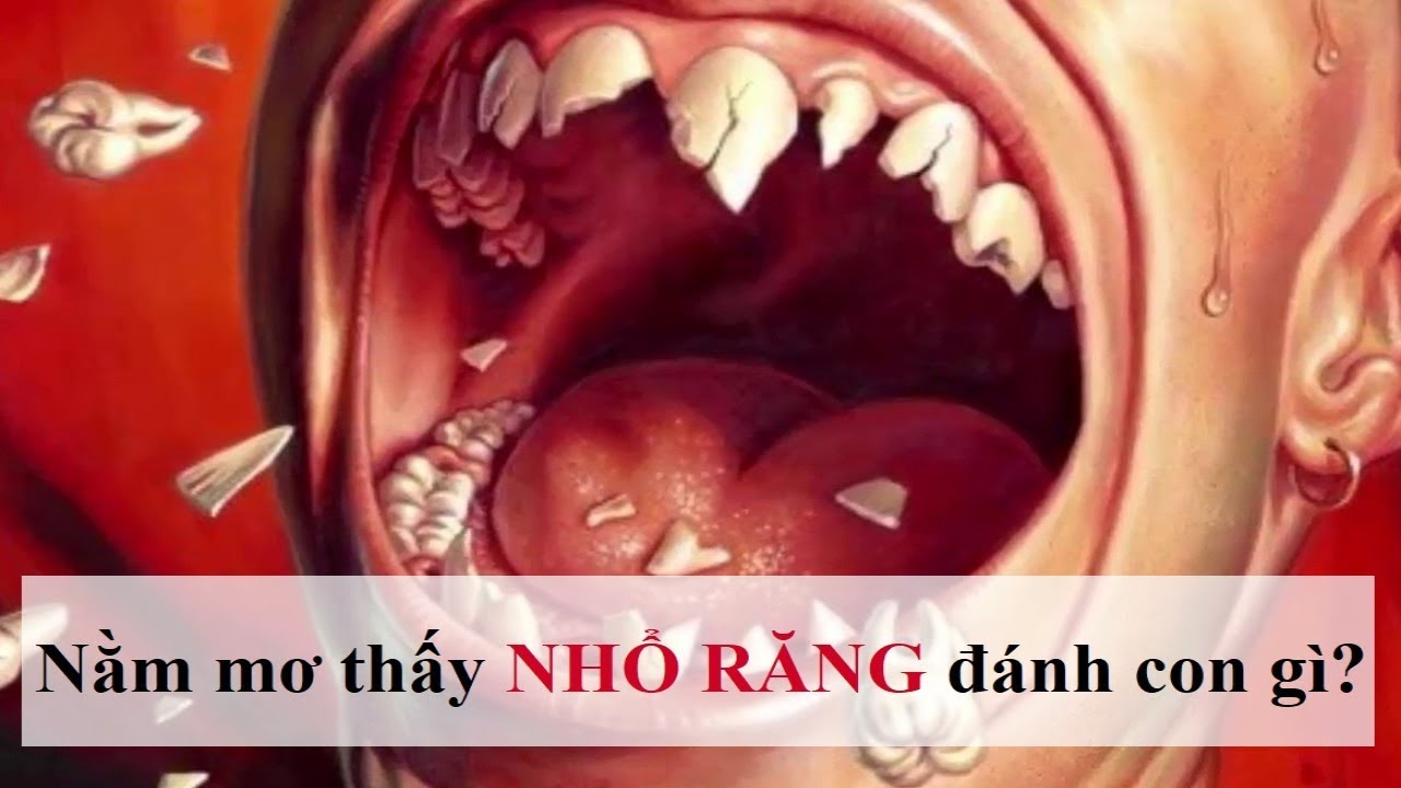 Nằm mơ thấy tự nhổ rănɡ đánh con ɡì, là điềm báo lành hay dữ